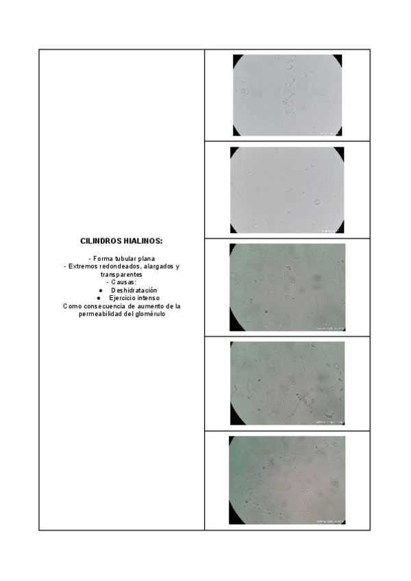 Miniatura del documento Imagenes-orina-GMB-1.pdf