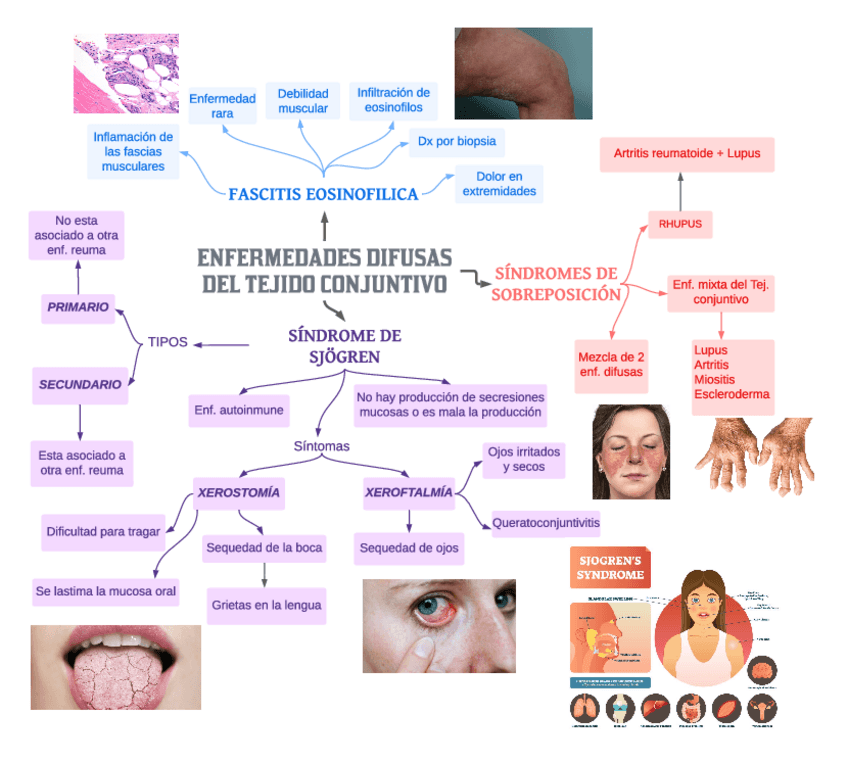 Miniatura del documento Enf.-difusas-del-Tej.-Conectivo-2.pdf