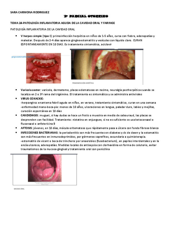 Miniatura del documento 2o-PARCIAL-OTORRINO-SARA-CARMONA.pdf