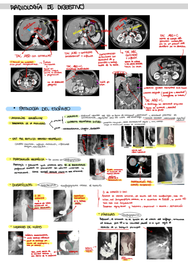 Miniatura del documento Apuntes-digestivo.pdf