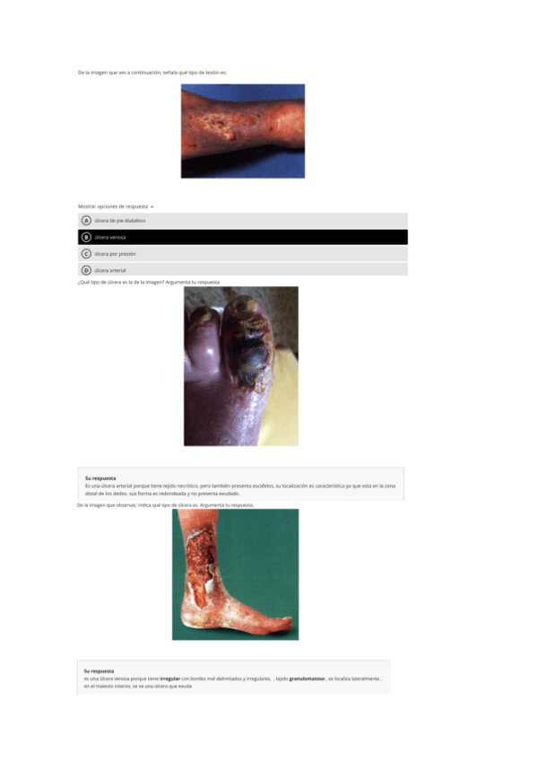 Miniatura del documento SEMINARIO-ULCERAS.pdf