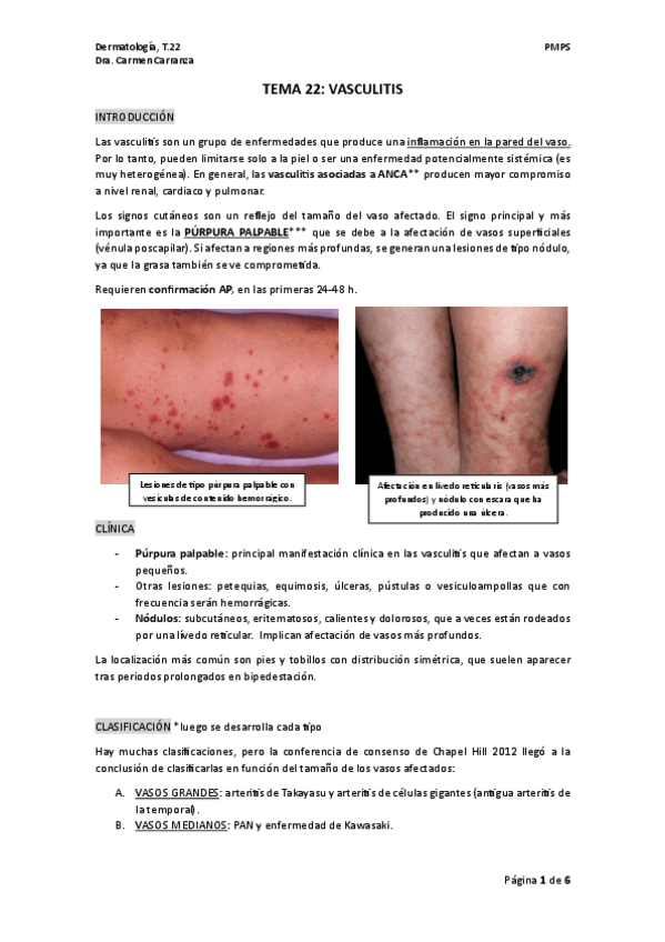 Miniatura del documento TEMA-22.-VASCULITIS.pdf