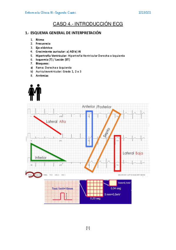 Miniatura del documento CASO-4.-INTRO-ECG.pdf