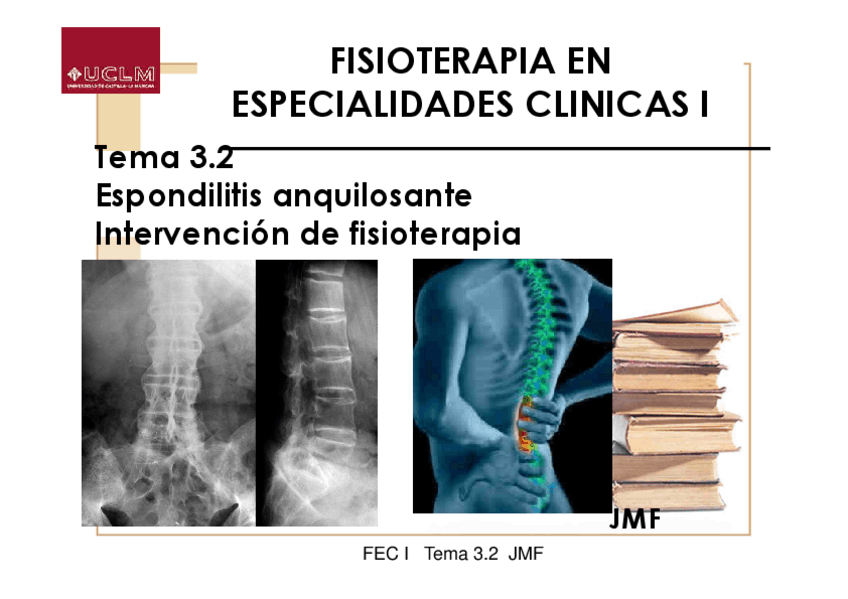 Miniatura del documento Tema-3.2-Espondilitis-Anquilosante.pdf