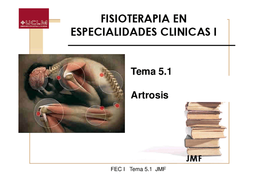 Miniatura del documento Tema-5.1-Artrosis.-Etiopatogenia-clasificacion-y-epidemiologia-de-la-artrosis.pdf
