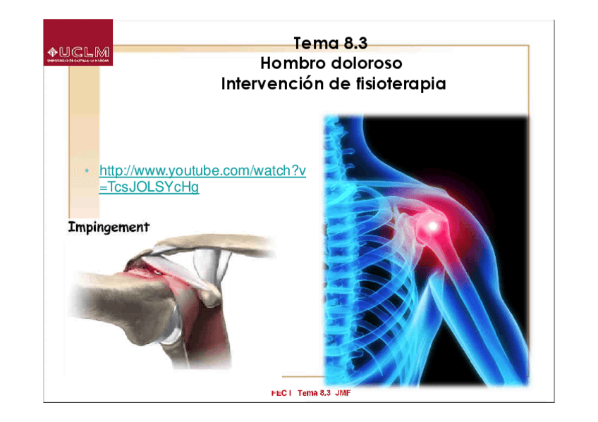 Miniatura del documento Tema-7-Hombro-doloroso.pdf