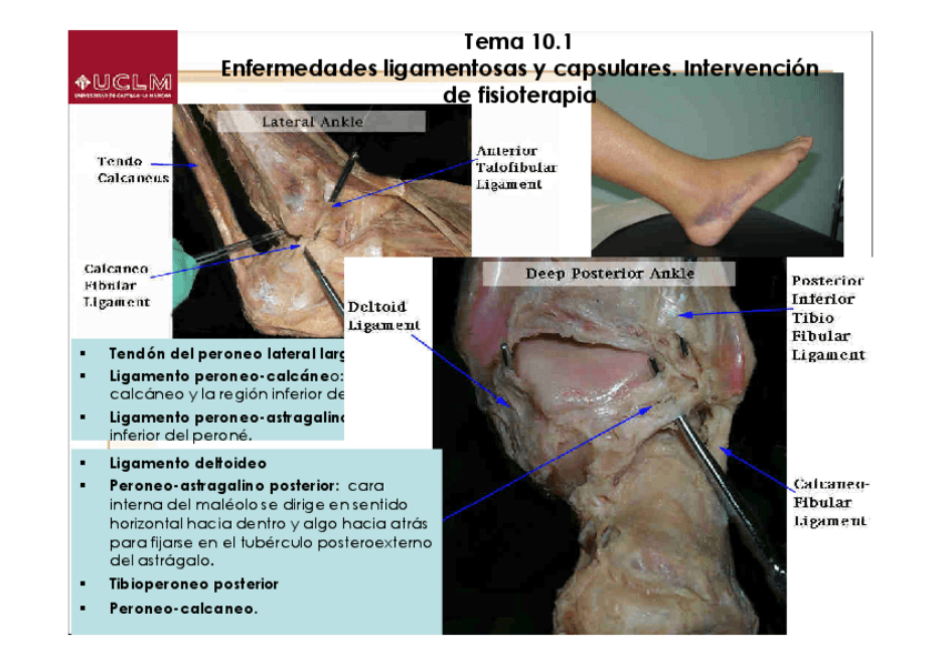 Miniatura del documento Tema-8.2-Enfermedades-ligamentosas-y-capsulares.-Intervencion-de-fisioterapia.pdf