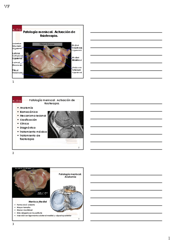 Miniatura del documento Tema-8.4-Patologia-meniscal.-Actuacion-de-fisioterapia-alumnos.pdf