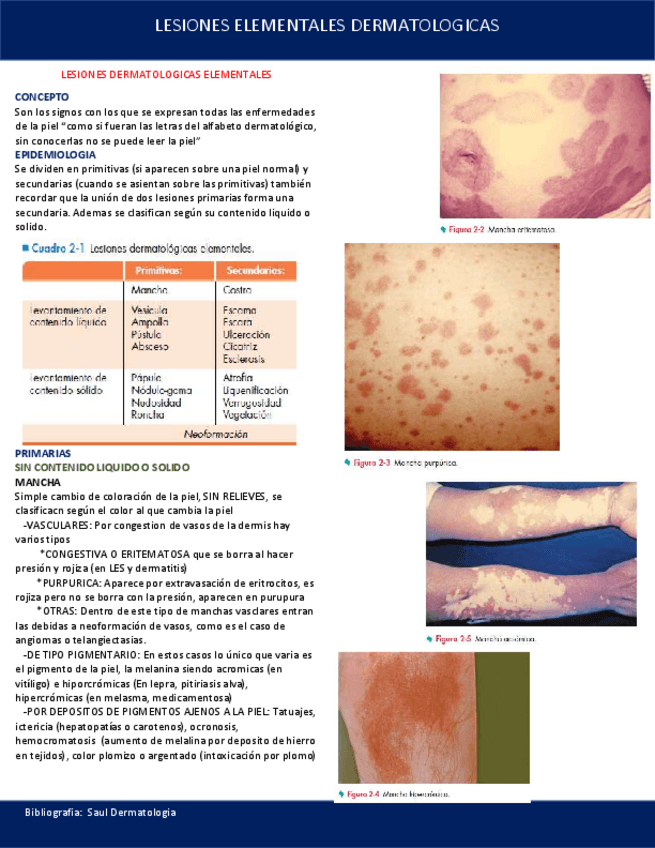 Miniatura del documento LESIONES-ELEMENTALES-DERMATOLOGICAS.pdf