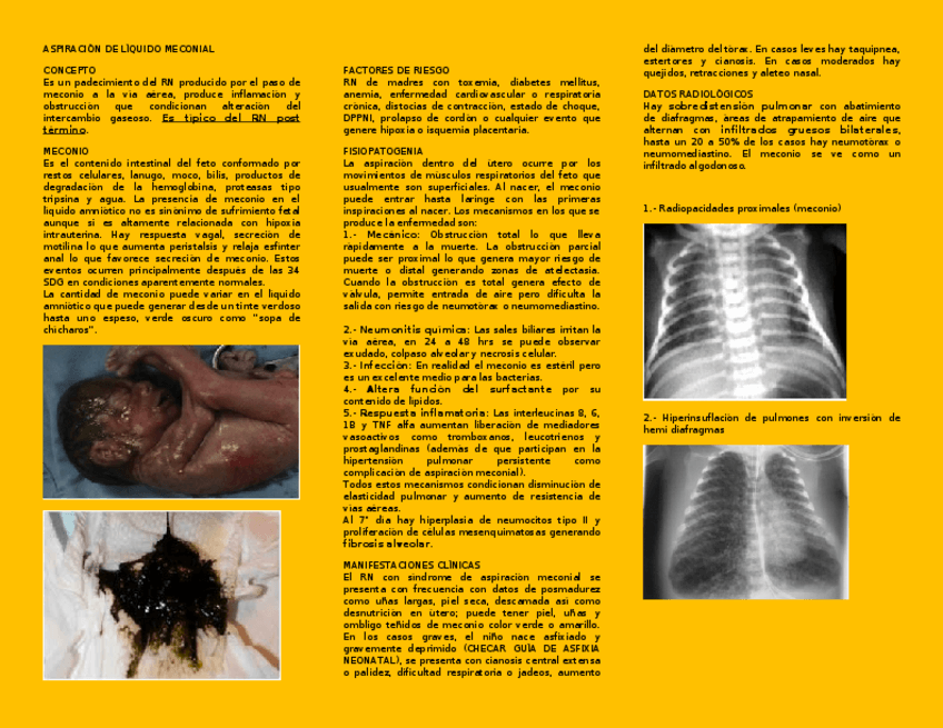 Miniatura del documento ASPIRACION-DE-LIQUIDO-MECONIAL.docx