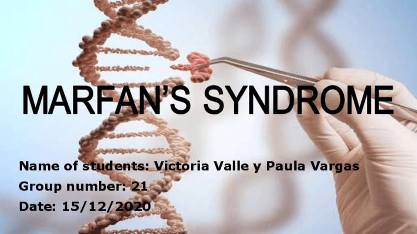 Miniatura del documento MARFANS-SYNDROME.pdf