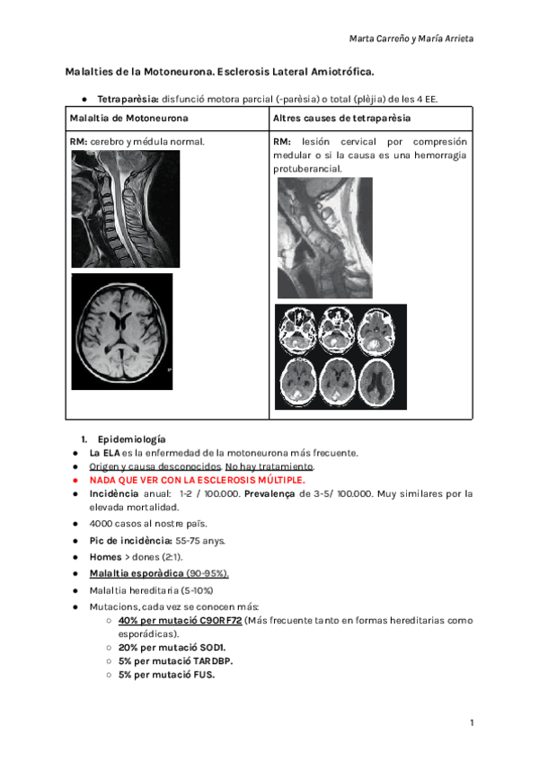 Miniatura del documento Malalties-de-la-Motoneurona-1-1.pdf