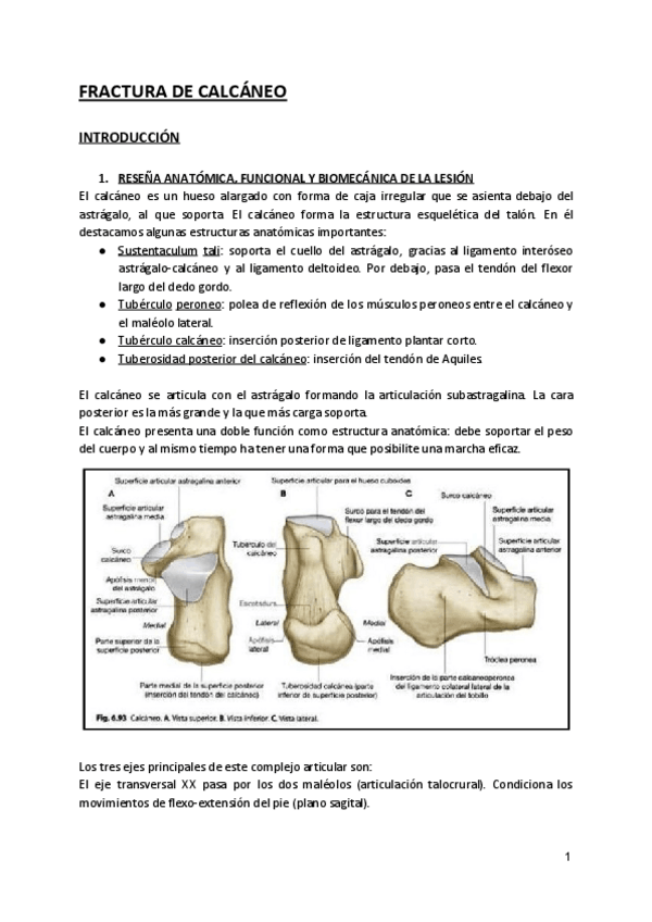 Miniatura del documento TRABAJO BERNABÉ - FRACTURA DE CALCÁNEO.pdf