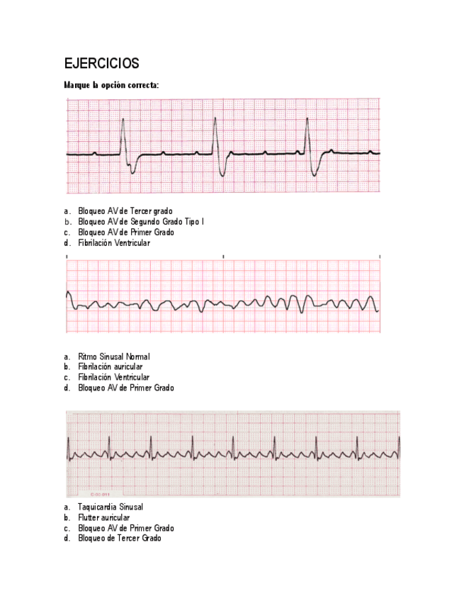 Miniatura del documento EJERCICIOS SEMINARIO ELECTROCARDIOGRAMAS.pdf