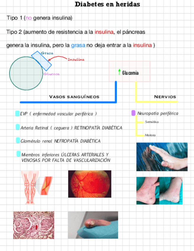 Miniatura del documento DIABETES-EN-HERIDAS.pdf