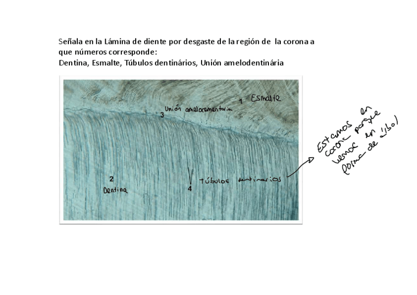 Miniatura del documento Diente-ejercicio-II.pdf