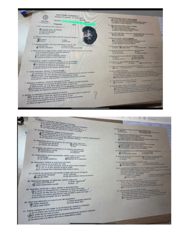 Miniatura del documento Examen-1-parcial-antomia-2.pdf