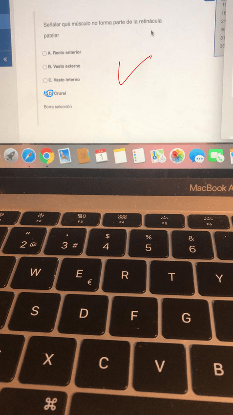 Miniatura del documento RECU-JULIO-AMBOS-PARCIALES-2019-20.pdf