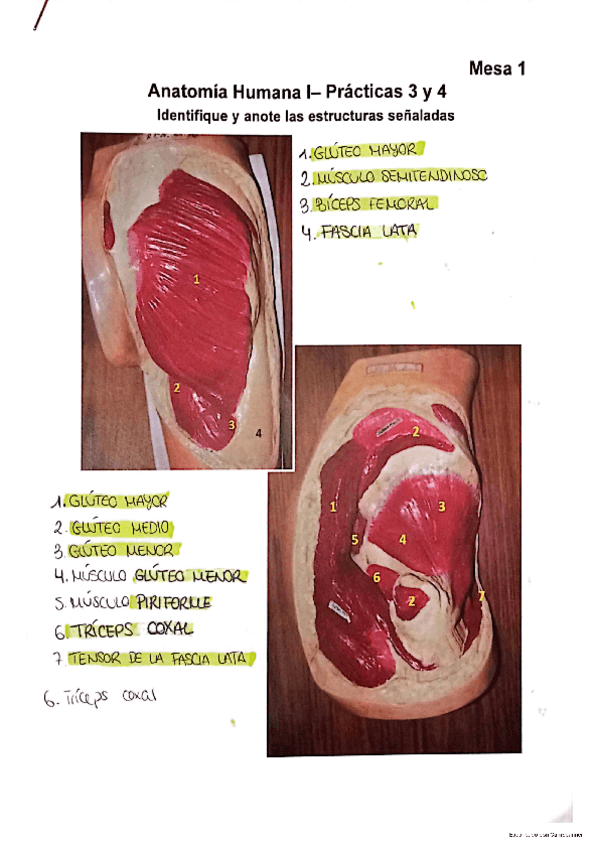Miniatura del documento Practica-3-y-4.-Diseccion-de-cintura-pelviana-y-muslo.pdf