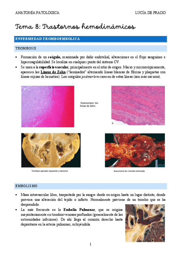 Miniatura del documento Trastornos-hemodinamicos-2425.pdf