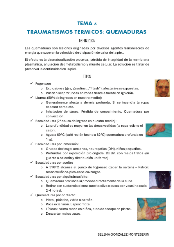 Miniatura del documento TEMA-6-pdf.pdf