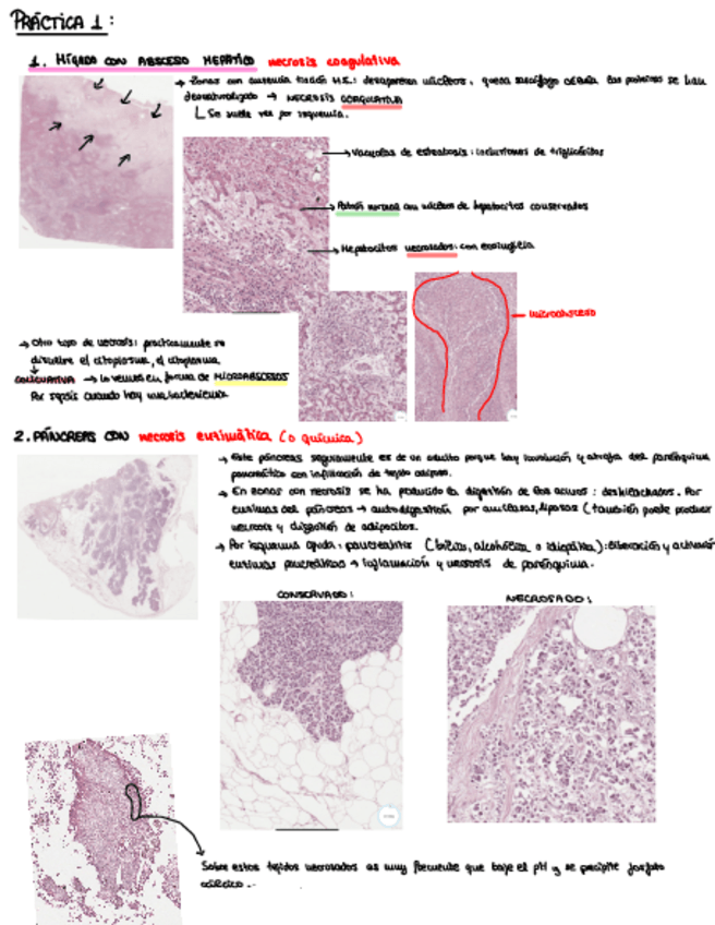 Miniatura del documento Practica-1-anatomia-patologica-2024.pdf