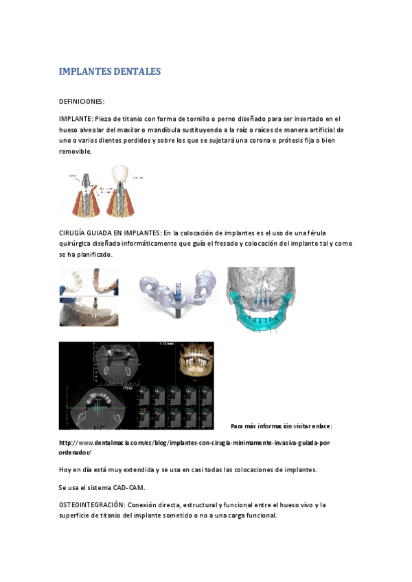 Miniatura del documento IMPLANTES-DENTALES.pdf