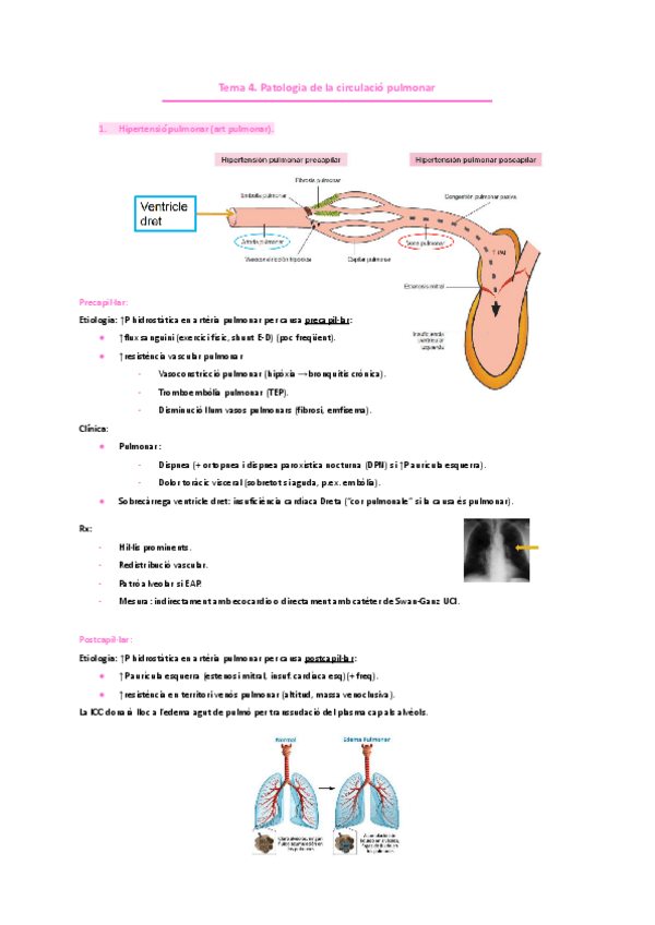 Miniatura del documento PNEUMOLOGIA.-Tema-4.-Patologia-de-la-circulacio-pulmonar..pdf