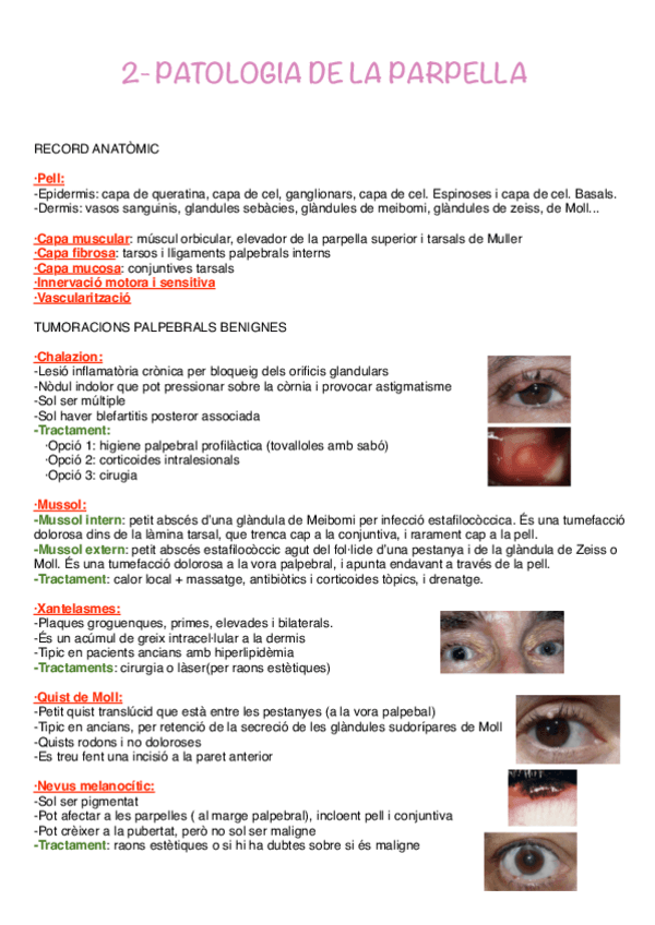Miniatura del documento 2-PATOLOGIA-DE-LA-PARPELLA.pdf