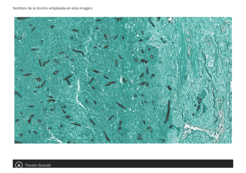 Miniatura del documento Practica-histopatologia-aviar.pdf