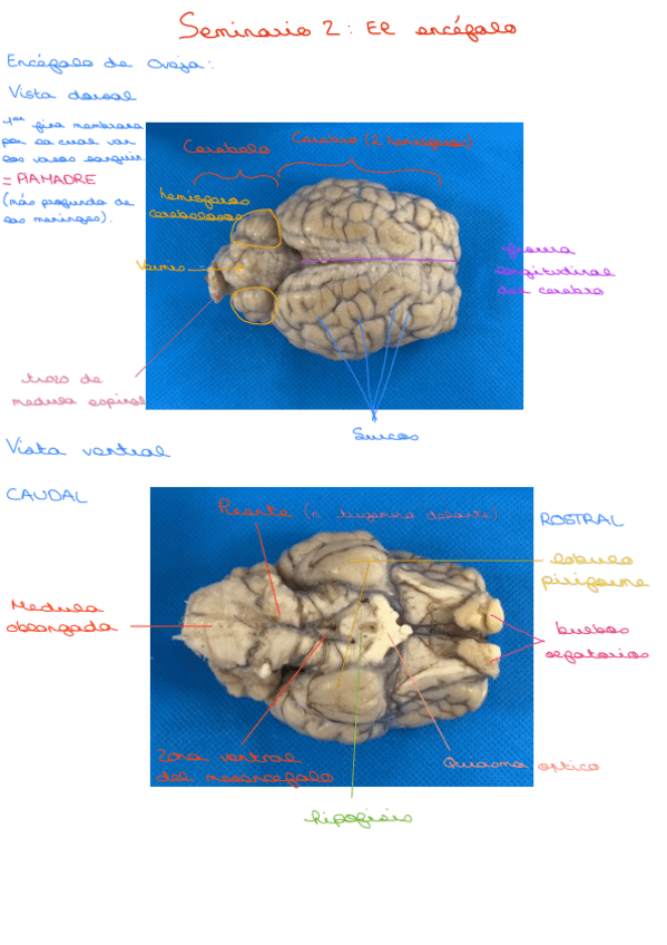 Miniatura del documento Seminario-El-encefalo.pdf