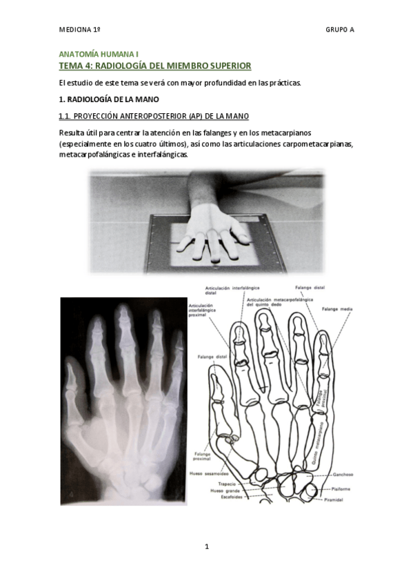Miniatura del documento TEMA 4 - RADIOLOGÍA DEL MIEMBRO SUPERIOR.pdf