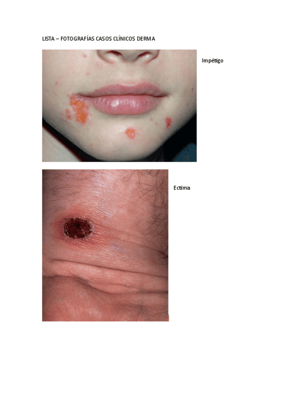 Miniatura del documento TODAS-LAS-FOTOS-DE-POSIBLES-CASOS-2023.pdf