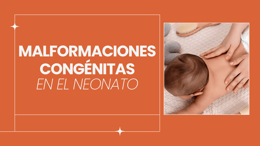 Miniatura del documento Malformaciones-congenitas-del-RN-recien-nacido.pdf