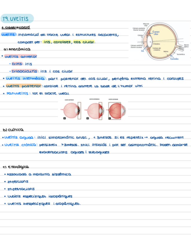 Miniatura del documento T9.-Uveitis.pdf
