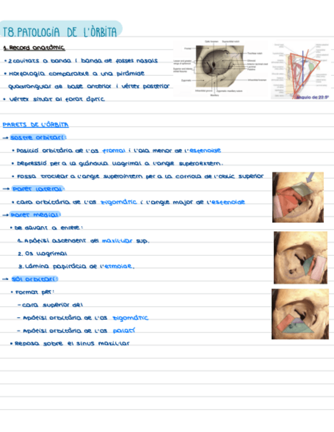 Miniatura del documento T8.-Patologia-Orbita.pdf