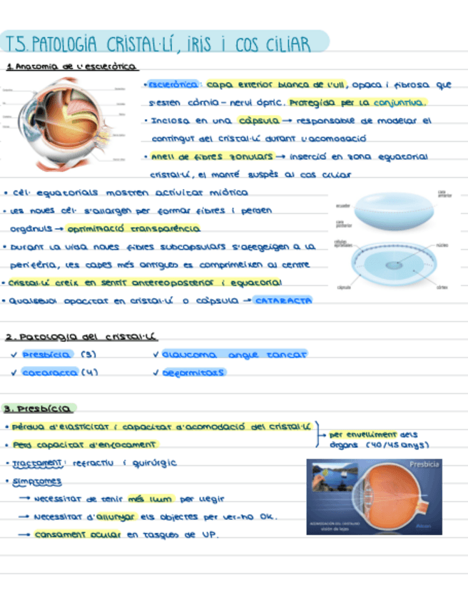 Miniatura del documento T5.-Patologia-Cristal.li-iris-cos-ciliar.pdf