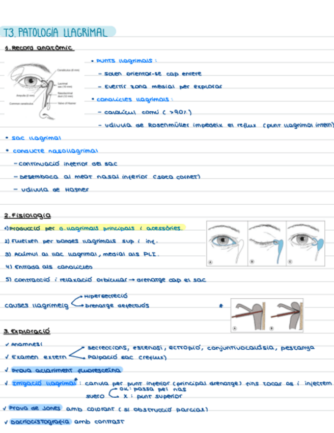 Miniatura del documento T3.-Patologia-Llagrimal.pdf