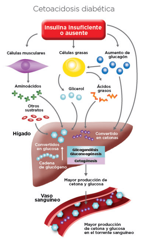 Miniatura del documento Cetoacidosis-Diabetica.pdf