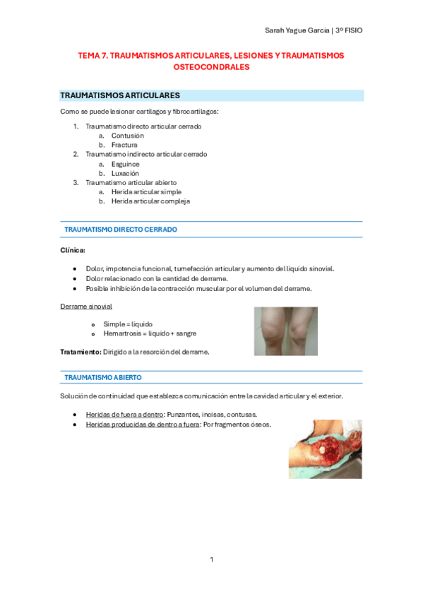Miniatura del documento T7-Traumatismos-articulares-lesiones-y-traumatismos-osteocondrales.pdf