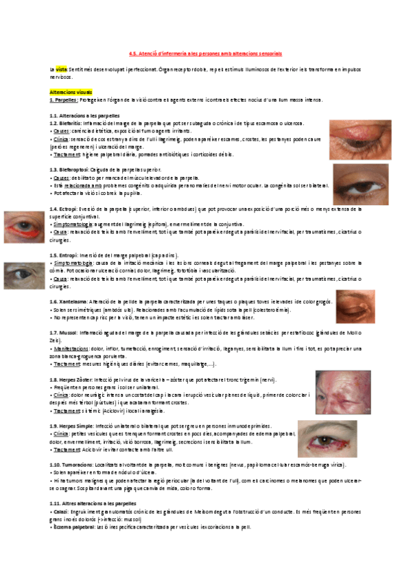 Miniatura del documento 4.5.-Atencio-dinfermeria-a-les-persones-amb-alteracions-sensorials.pdf