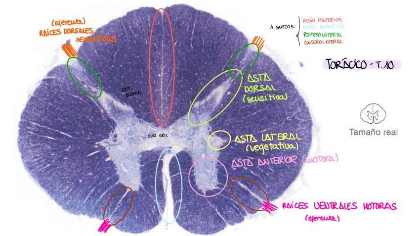 Miniatura del documento MEDULA-ESPINAL-IMAGENES.pdf