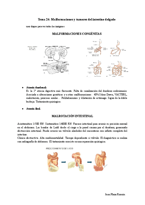 Miniatura del documento Tema-24-Malformaciones-y-tumores-del-intestino-delgado.pdf