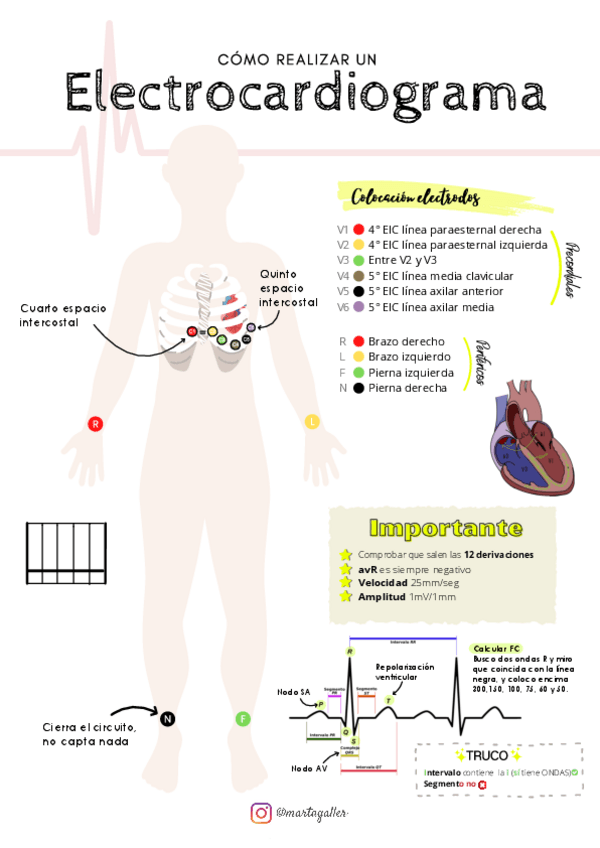 Miniatura del documento Electrocardiograma.pdf