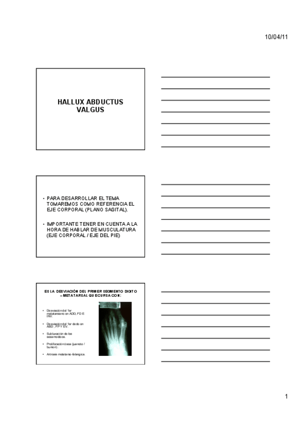 Miniatura del documento TEMA-08.1-HALLUX-ABDUCTUS-VALGUS.pdf