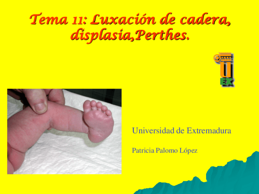 Miniatura del documento Tema-11-Luxacion-de-cadera-displasia-Perthes.pdf