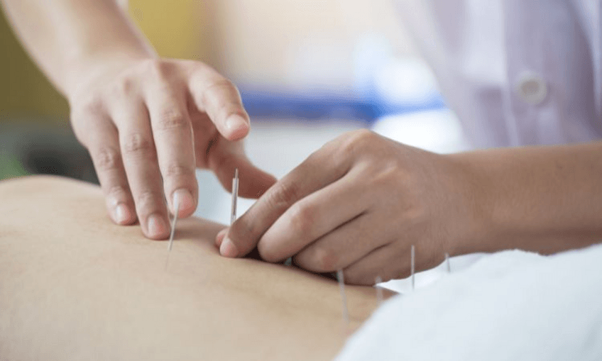 Miniatura del documento acupuntura-puntos.pdf