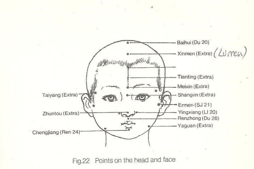 Miniatura del documento cabeza-nino-acupuntura-puntos.pdf