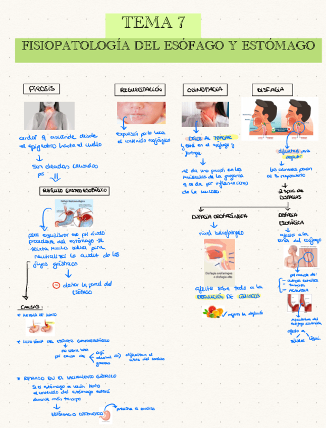Miniatura del documento TEMA-7-Fisiopatologia-del-esofago-y-estomago.pdf