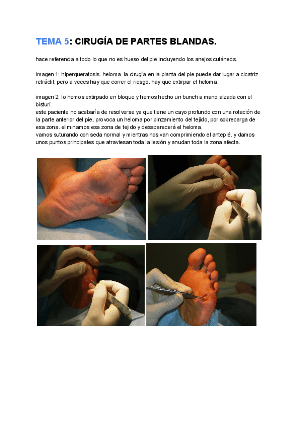 Miniatura del documento TEMA 22_ CIRUGÍA DE PARTES BLANDAS.pdf